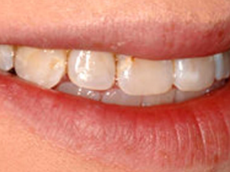 Before image